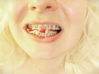 LONG jelly candies FOOD FETISH in BRACES - ASMR video