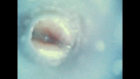 Visualizações internas - Endoscópio dentro da bunda, pau, boca - inserção anal endoscópio, inserção uretral