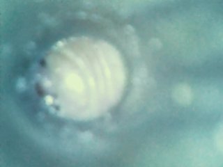 Internal views - Endoscope inside ass , cock , mouth - endoscope anal insertion, urethral insertion