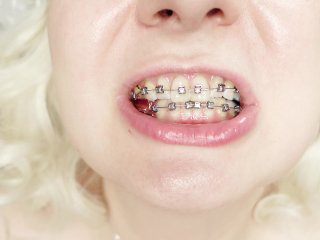 Braces Fetish: Close Up Video Mukbang_Jelly Candy