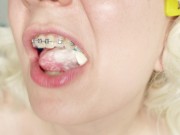 Preview 5 of braces fetish: close up video mukbang ice-cream