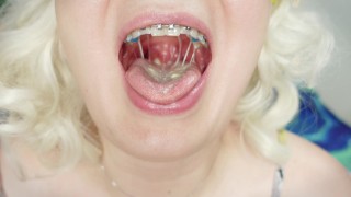 braces fetish: close up video mukbang tasty ice-cream
