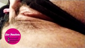 Hairy vagina palpitations 