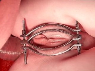 Painal Anal Metal Clamped Teen Pussy Is Fucked in Ass andPussy Emotional Little Ass IsIn Trouble