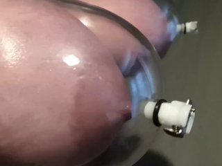 vacuum tits, breast expansion, breast inflation, engorged breasts