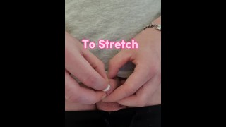 Treatment 2 Stretching Tight Foreskin