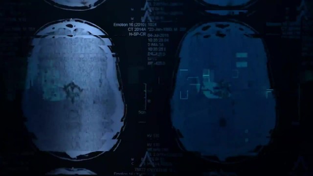 PervDoctor - Arzt Fickt Heiße Vollbusige Patientin JC Wilds Und Krankenschwester Mit Großen Natürlichen Titten Electra Rayne