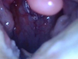 esophagus, pov, teeth, throat
