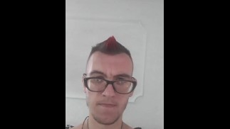 Moja guza