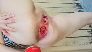 EXTREME ANAL INSERTIONS IN PUBLIC PLAY ANAL FISTING PLAY WITH A COKE CAN