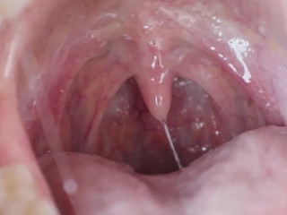 My Sexy Wet Uvula - HD TRAILER