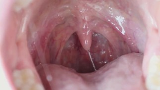 My Sexy Wet Uvula - HD TRAILER