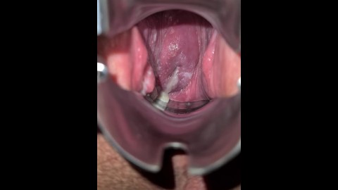 Join my Fans for Endoscope Camera and Speculum Inspections of my Horny Pregnant Cunt and Cervix