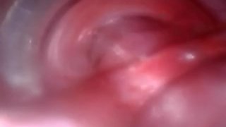 Masturbation with urethral mouth foreign  body insertion and sucking vibrator