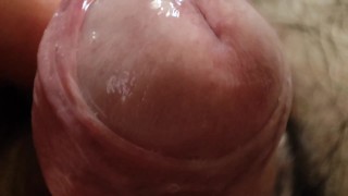 Close-Up Of The Foreskin Being Pulled Back