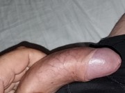 Preview 3 of Sliding foreskin on fat, veiny European cock