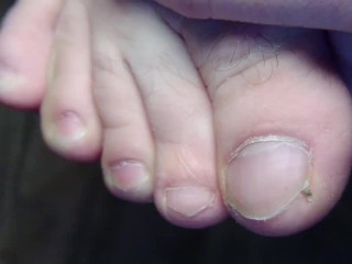 Подстригаю уродливые ногти на ногах