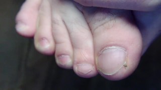 Recortando mis uñas feas de los pies