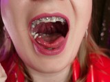 mukbang ASMR eating video FOOD FETISH in braces