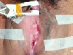 クリトリス 電気責め 吸引