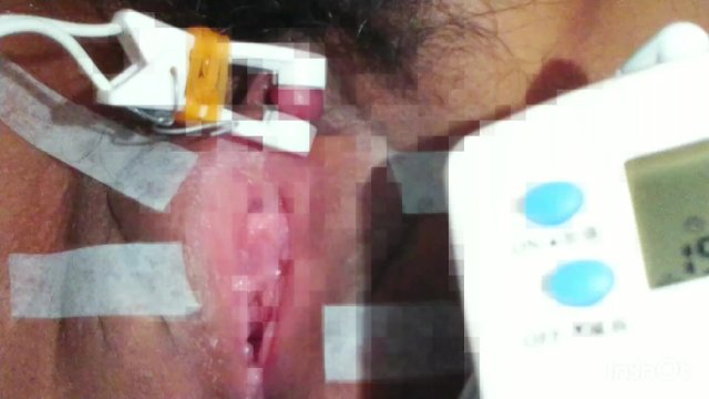 Watch Bondage Video:クリトリス 電気責め 吸引