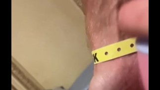 ERSTE KIRSCHE AUF DER NABE GEPLATZT