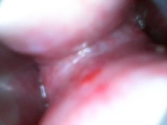 Do you want to see inside my peehole 