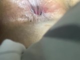 Close up anal play