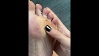 Dirty foot