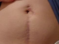Ultimately Hot Beautiful Scar Exposed