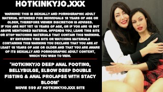Stacy Bloom Hotkinkyjo Deep Anal Footing Bellybulge Elbow Deep Double Fisting And Anal Prolapse