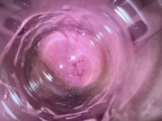 Preview 1 of Hot teen sticks camera inside her vagina