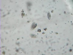 Watching Hairy Tiny Squishy cells Getting Separated (cell division of protozoa/ciliates)