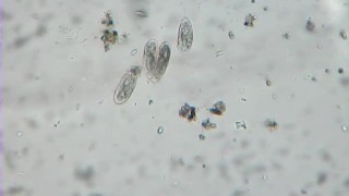 Kijken hoe harige kleine squishy ballen gescheiden worden (celdeling van protozoa/ciliaten)
