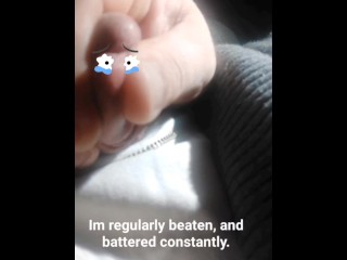 Тупые тупые штуки