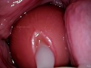 Preview 1 of Camera in Vagina, Cervix POV, "Creampie"