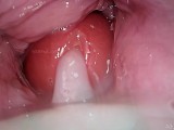 Cámara en vagina, cervix POV, "Creampie"