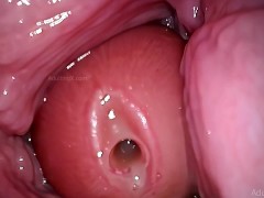 Video Camera in Vagina, Cervix POV, "Creampie"