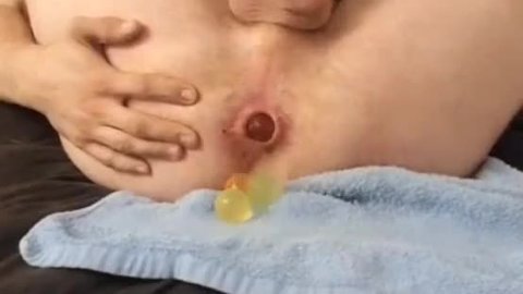 Filling his Ass with Balls