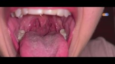 mouth