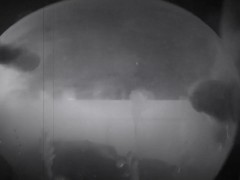 Huge cumshot in an inflated condom