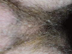 Pulsating Hairy Butthole