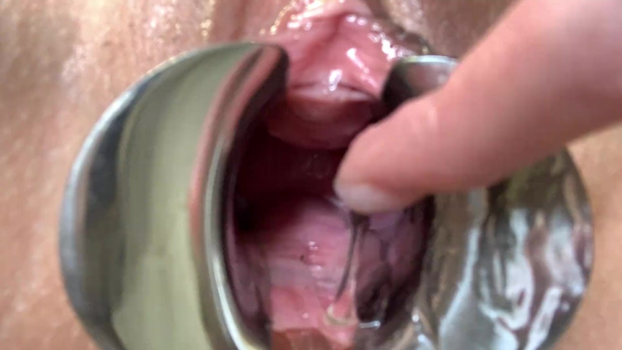 wet pussy closeup speculum 