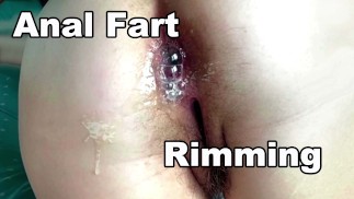 STEPMOM Hairy Ass Pussy. Hairy Asshole anal COUGAR MILF. Amateur Rimjob. Milf Rimming. Hairy Pussy.