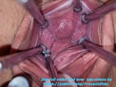 Wide open Pussy Looks inside