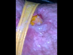 orange in BBW’s slimy ruined asshole held in place by yellow thong