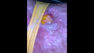 Orange In Bbw's Slimy Ruined Asshole Held In Place By Yellow Thong