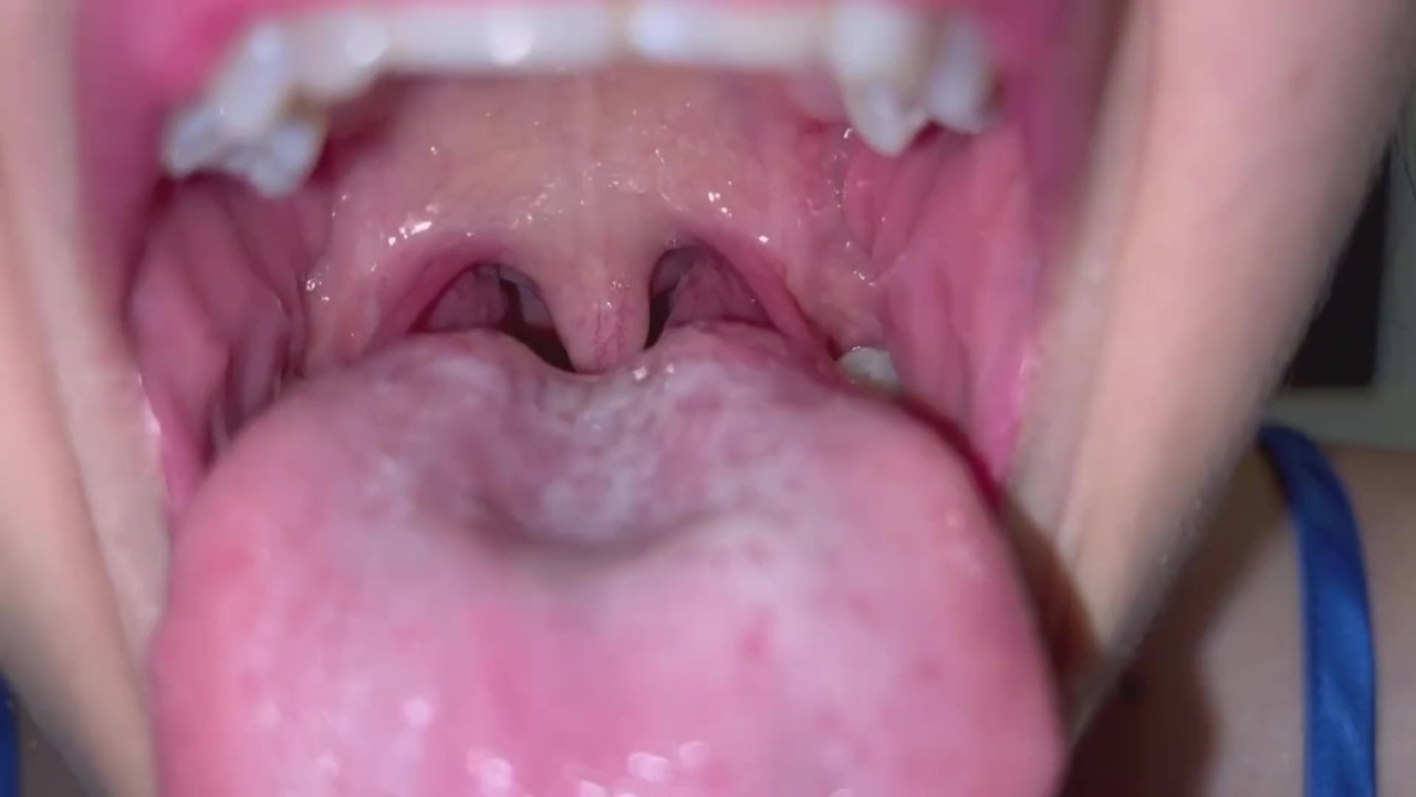Giantess uvula