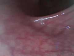 The colonoscopy. The rough intestine research of the bowel