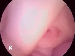 【解剖生理学】超小型カメラで元看護師の私が膣内を観察し紹介します。 - Screenshot 14 of 16 - Mature Woman